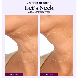 Let's Neck - Neck Serum w/ Cooling Applicator